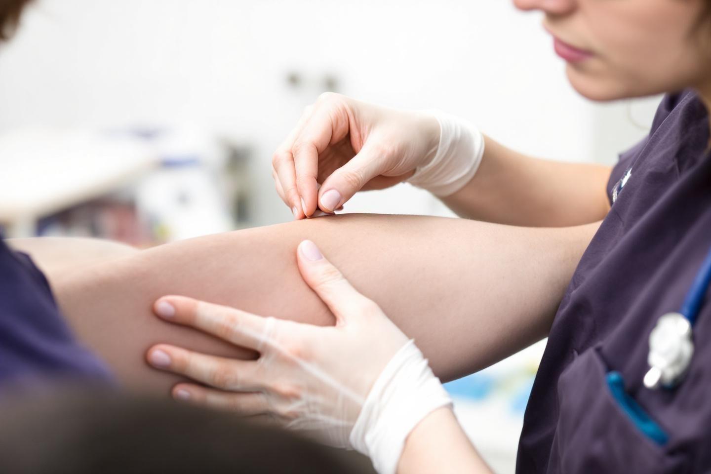 Périostite de l'avant-bras : causes, symptômes et traitement